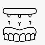 NucleOSS Accessories